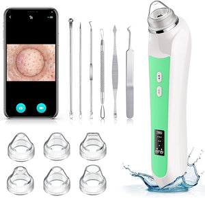 Facial Pore Blackhead Remover Vacuum, 1080P Camera Blackhead Remover, 20x Zoom, 8 LEDs £¦ 3 Suction Modes, 800mAh Battery &amp; USB - 6 Heads Pore Cleaner Kit for Women&amp;Men(Green)