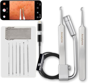 Luma 1 Visual Blackhead Remover Tweezers with Camera - Pimple Popper Tool with Camera 20x Magnification 1080P 8 LED Lights with 2* Alloy Steel Tweezers and Blackhead &amp Pimple Popper Tool Kit (6