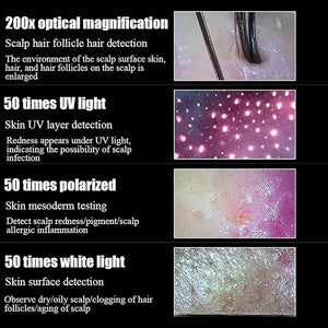 HD Scalp Analyzer Skin Hair Scalp Detector with 14.1 inch LCD Screen 22¡Æ Angle Adjustment 10 Million Pixels and 4 Frames Comparison for Beauty Salon Home Hair Salon