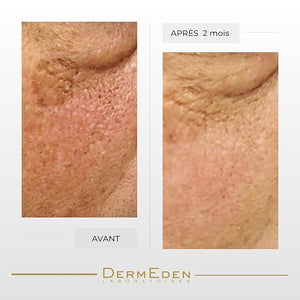 DERMEDEN NIGHT PROTOCOLE INTENSE ANTI-AGEING EYE CONTOUR CREAM 15ML ¡¦