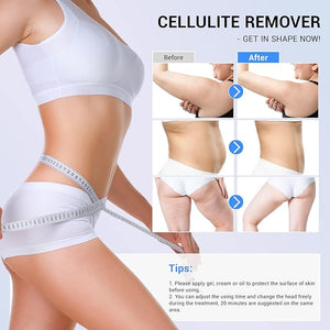 sens for Improvement in The Appearance of Cellulite Device Cellulite Massager Radio Frequency White