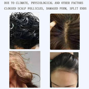 Hair Follicle Analyser Machine Hair Scalp Detector with Massage Function 5 Diagnosis Hair Tools Skin Care for Traveling Home Beauty SalonN