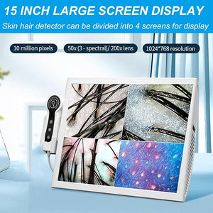 Trispectrum Skin Hair Scalp Detector Hair15 Inch Hd LCD Quad Screen Switching200X Hd Lens and 50X Tri Spectral Lensfor Home Scalp Care220V