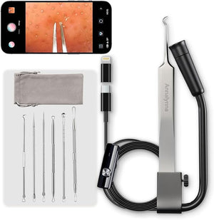 Luma 1 Visual Blackhead Remover Tweezers with Camera - Pimple Popper Tool with Camera 20x Magnification, 1080P, 8 LED Lights, with Blackhead Remover Pimple Popper Tool Kit (6 Piece Kit),Black