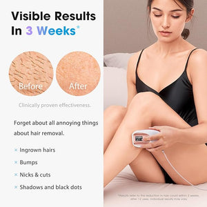 IPL Laser Hair Removal Device for Women &amp Men - Home 45¡ÆF Ice-Cooling Contact for Painless &amp Long-Lasting Results 86% Hair Reduction in 3 Weeks for Full Body &amp Bikini Line Rose Gold
