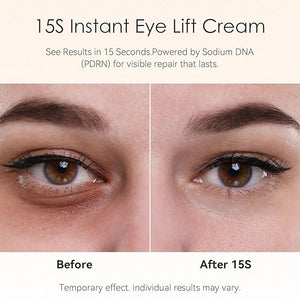 15-Second Instant Eye Lift Cream with Sodium DNA &amp 0.1% Retinal | Rapid Tightening for Eye Bags &amp Fine Lines | Dual-Action Firming + Long-Term Repair | Caffeine Peptides &amp Collagen Comple