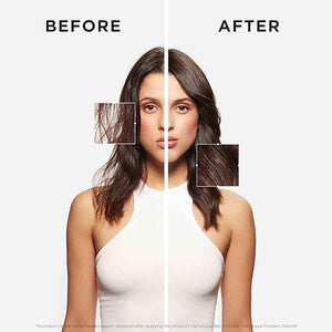 Kerastase Densifique Densit? Shampoo - Thickening &amp Strengthening For Fine &amp Thinning Hair Removes Build-Up &amp Adds Shine With Hyaluronic Acid