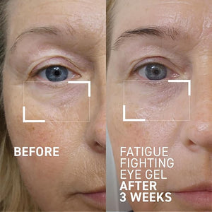 Dr. Brandt iD-STRESS Fatigue Fighting Eye Gel - 0.5 fl oz, Pack of 2 - Rapidly Diminishes Signs of Dryness, Fatigue &amp; Dark Circles in the Eye Area