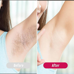 Roll On Wax Kit Portable Wax Roller Kit for Hair Removal Beginners Waxing Kit Soft Heater for All Skin Types with 3 Pcs 100g Roll on Cartridge 100 Non-Woven Strips &amp 10 After Oil Wipes (F8_Whit