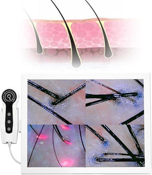 Skin Hair Scalp Detector Hair Follicle Facial Skin Oil Moisture 15 Inch HD LCD Screen Microscope Tester