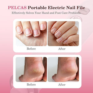 PELCAS Electric Nail File, 10 Speeds Cordless Nail Drill with LED Light, Portable Manicure and Pedicure Kit, Nail Grinder with LCD Screen for Human, Pet, Thick Toenails, Natural &amp; Acrylic Nails