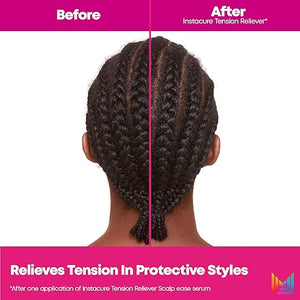 Matrix Instacure Tension Reliever Leave-In Scalp Serum - Moisturizes Dry and Irritated Scalp Cools Tension in Braids Protective &amp Tight Hairstyles 6.8 Fl Oz