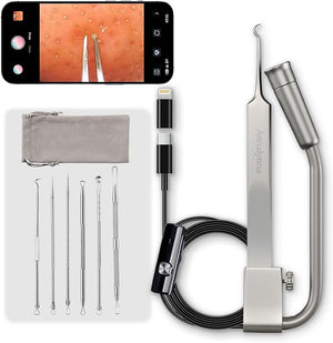 Luma 1 Visual Blackhead Remover Tweezers with Camera - Pimple Popper Tool with Camera 20x Magnification, 1080P, 8 LED Lights, with Blackhead Remover Pimple Popper Tool Kit (6 Piece Kit),Titanium
