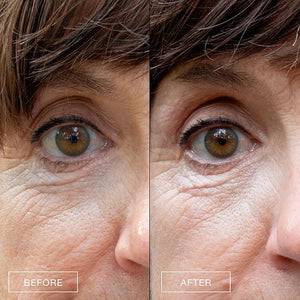 Boom Awaken Cooling Under Eye Cream - Targets Puffiness &amp Uneven Tone with Vitamin C Licorice Root Wild Mint Green Tea &amp Hyaluronic Acid - Lightweight Refreshing Vegan Formula - 0.5 oz