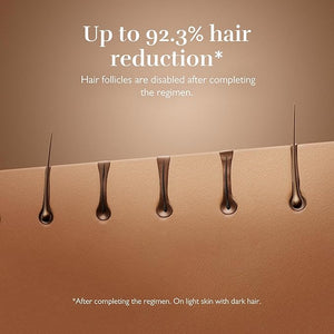 Silk'n Hair Removal Device for Women and Men Silk'n 7 Professional IPL with Rotating Head Painless Salon-Quality Results Starting in 3 Weeks Face and Body with 3 Smart Attachments Black