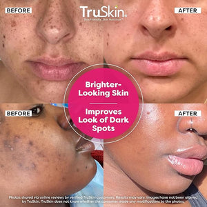 TruSkin Vitamin C Super Serum - Niacinamide, Retinol, Hyaluronic Acid &amp; Squalane - All-in-One Anti Aging Serum for Face ? Improve Appearance of Dark Spots, Firmness for Brighter Looking Skin, 1 Fl