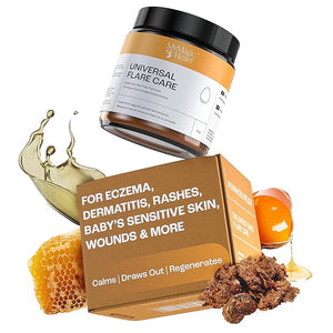 MyMagicHealer Universal Flare Care | Essential Oil Free | Relief for Rashes Eczema Psoriasis Hidradenitis Suppurativa Impetigo Dermatitis Wound Care Sensitive Skin w/Propolis &amp Egg Yolk 4 o