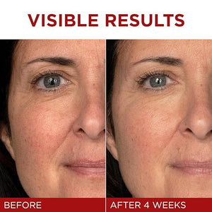 L'Oreal Paris Revitalift Triple Power Anti-Aging Face Moisturizer Pro Retinol Hyaluronic Acid &amp Vitamin C to Reduce Wrinkles Firm &amp Brighten Skin 1.7 Oz