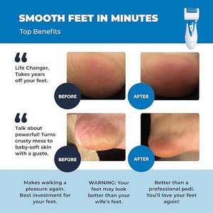 Electric Callus Remover: Own Harmony Professional Pedicure Tools Foot Care for Women Rechargeable Foot Scrubber CR900 Electronic Feet File Pedi Sander Best for Hard Cracked Dry Dead Skin 3 Rollers