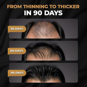 SPARTAN¢â Root Activator Conditioner For Men - Hair Growth Conditioner Thickening Hair Moisturizer for Hair Loss and Thinning Hair