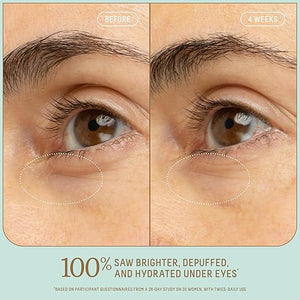 Biossance Squalane + 5% Niacinamide Eye Serum ? Brightening &amp Depuffing Treatment for Dark Circles ? Vitamin C &amp Caffeine Formula ? Stainless Steel Rollerball for Soothing Massage ? For All Sk