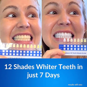 Polar MD Teeth Whitening Kit Professional Teeth Whitener Gel Pens 1YR. Supply Compare to Whitening Strips. Powerful 32 LED Wireless Activating Light.