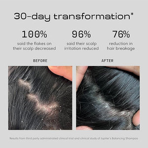 Jupiter Anti Dandruff Shampoo &amp Conditioner for Men &amp Women for Flaky Itchy Oily &amp Dry Scalp - Nourishes Scalp and Reduces Breakage &amp Flakes - Color-Safe Sulfate-Free Paraben-Free