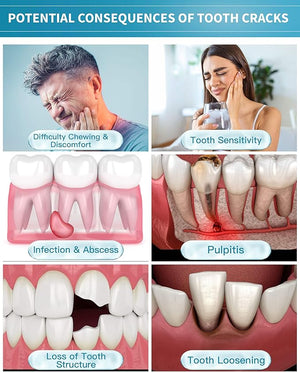 Healing Teeth Crack Toothpaste, The ONLY Toothpaste Repairing Cracked Teeth Enamel Cracks, Cure Tooth Sensitivity, Remove Pigment in Crack 100g 2 Counts As Mother's Day Gift