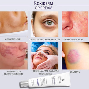 Vitamin K1 Oxiderm Cream Minimizing Appearance of Old and New Scars Dark Eye Circles Bruises Varicose Veins Purpura and Redness 1.01Oz