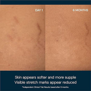 ELEMIS Japanese Camellia Body Oil Blend | Luxuriously Lightweight Body Oil Nourishes Conditions and Softens Pregnant and Postpartum Skin | 100 mL