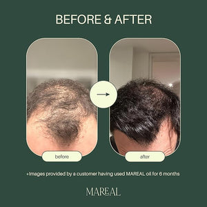 Pure Rosemary Oil for Hair Growth &amp Scalp Health | Infused with Castor &amp Coconut Oil | Hair Thickening &amp Regrowth Treatment for Women &amp Men | 100% Natural | Up to 2-Month Supply | 1.7