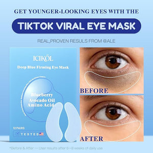 Collagen Under Eye Patches for Puffy Eyes and Dark Circles Under Eye Mask for Revitalization with Blueberry Hydrating Undereye Mask Patches for Treatment with Women Beauty (Blue 24 Pairs)