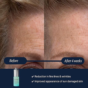 ELEMIS Pro-Collagen Renewal Serum 15ml Gentle Retinol Alternative for Smoothing Fine Lines &amp Wrinkles