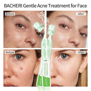 Gentle Botanical Acne Treatment for Face ? Acid-Free Spot Facial Serum with Niacinamide &amp; Witch Hazel, Soothes Redness &amp; Controls Breakouts for Sensitive, Oily &amp; Acne-Prone Skin ? 1.2 ml ¡¿