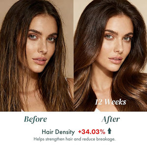 ALFHEIM Saw Palmetto Scalp Serum to Strengthen Follicles | With Caffeine &amp Biotin for Fuller Hair | Helps Balance Scalp Revive Hair Roots &amp Enhance Hair Density | 0.34 fl oz + Serum Applicato