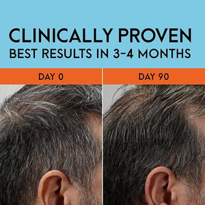 Just for Men Gray Reverse Daily Hair Serum Gradually Reduces Gray Hair Easy Dye-Free Serum 6.7oz