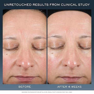 Lanc?me Advanced G?nifique Night Cream - Repairs Skin Barrier Overnight - With Bifidus Prebiotic Hyaluronic Acid &amp Triple Ceramide Complex - 1.7 Fl Oz